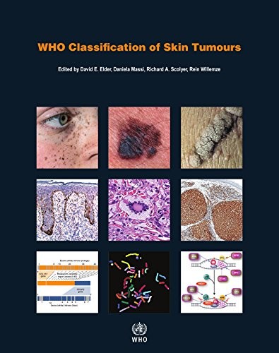 WHO Classification of Skin Tumours. 4 ed.