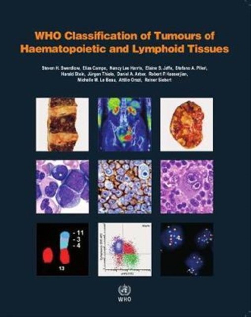 WHO Classification of Tumours of Haematopoietic and Lymphoid Tissues. Revized 4 ed.