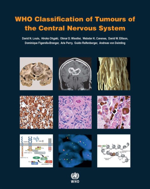 WHO Classification of Tumours of the Central Nervous System, Revised.4 Ed