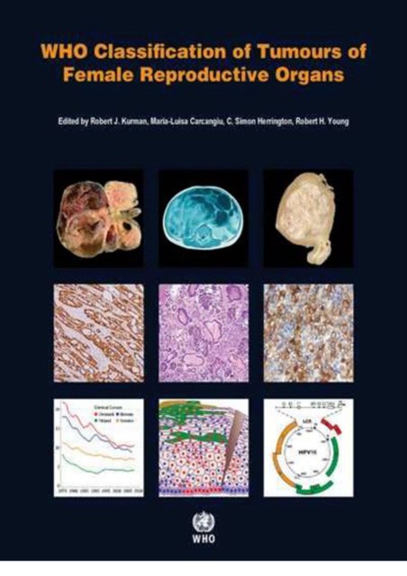 WHO Classification of Tumours of the Lung, Pleura, Thymus and Heart. 4 ed.