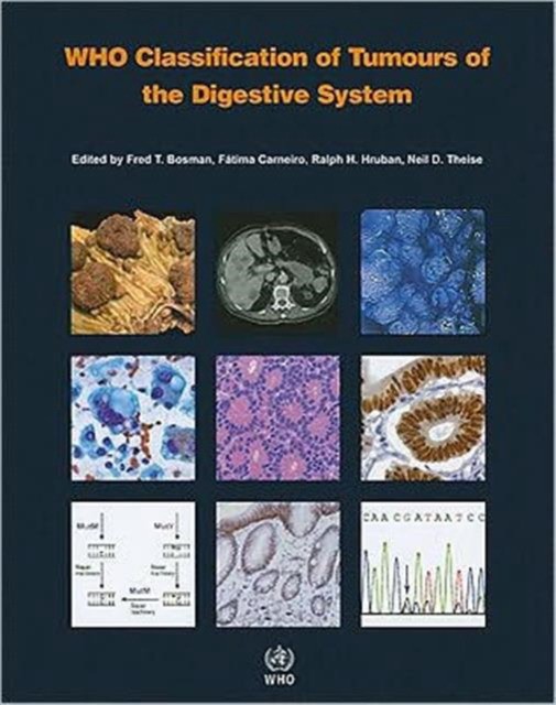 WHO Classification of Tumours of Digestive System
