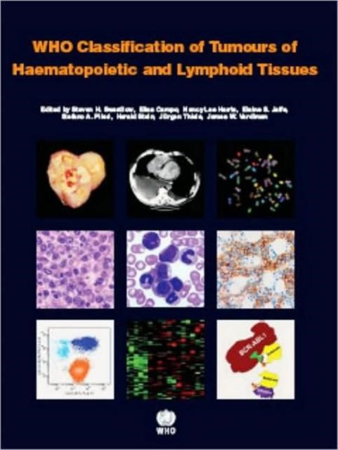 WHO Classification of Tumours of Haematopoietic and Lymphoid Tissues