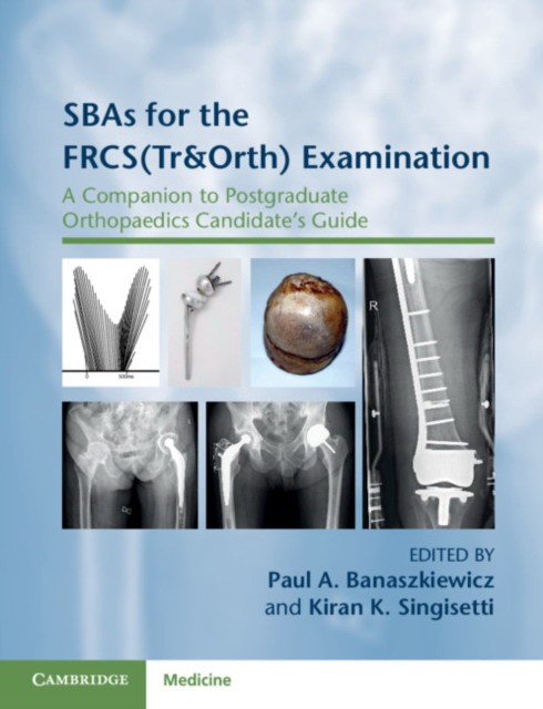 SBAs for the FRCS(Tr&Orth) Examination: A Companion to Postgraduate Orthopaedics Candidate's Guide SBAs for the FRCS(Tr&Orth) Examination: A Companion to Postgraduate Orthopaedics Candidate's Guide