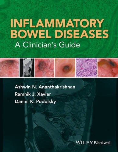 Inflammatory Bowel Diseases: A Clinician's Guide