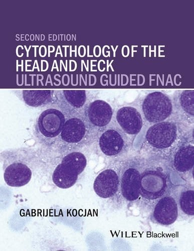Cytopathology of the Head and Neck: Ultrasound Gui ded FNAC, Second Edition