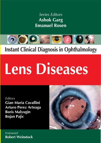 Lens Disease