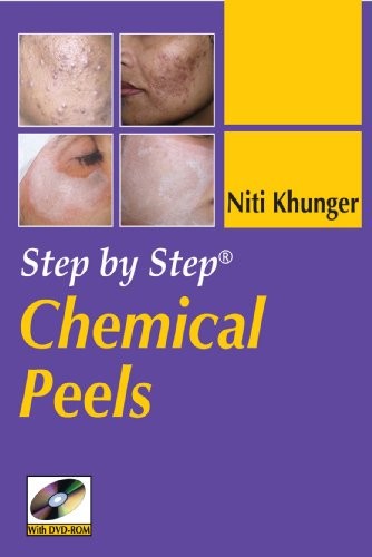 Step-By-Step Chemical Peels