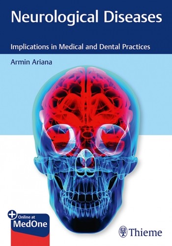 Neurological Diseases: Implications in Medical and Dental Practices
