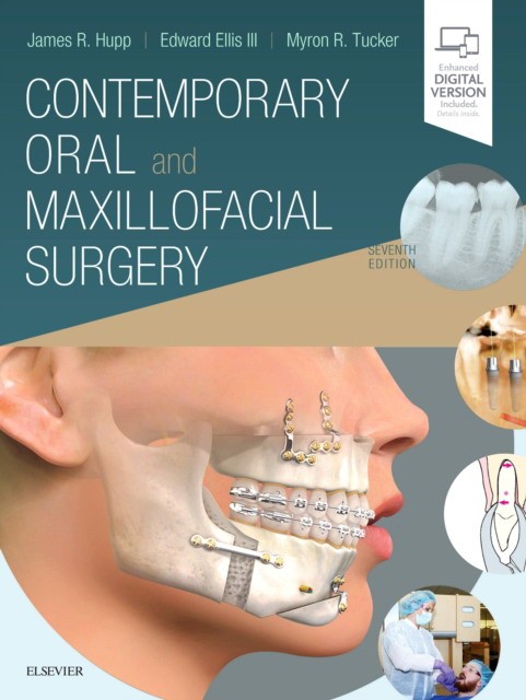 Contemporary Oral and Maxillofacial Surgery, 7th Edition.- Mosby, 2019 СОЕДИНЕННОЕ КОРОЛЕВСТВО ISBN: 9780323552219