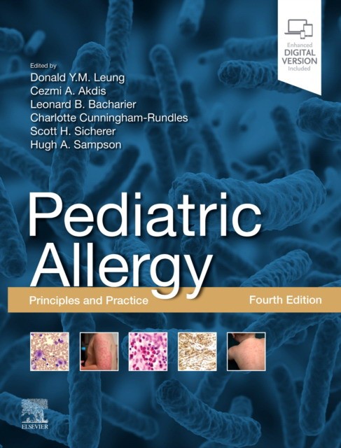 Pediatric Allergy: Principles and Practice / Y. M. Leung e Donal. - 4 ed. - Elsevier Science, 2020. - 440 p. - ISBN 9780323674621