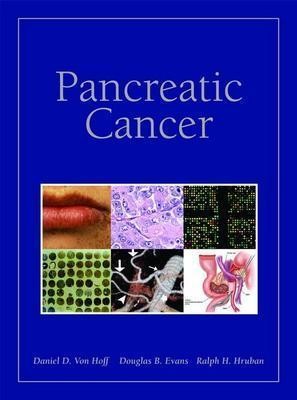 Pancreatic cancer