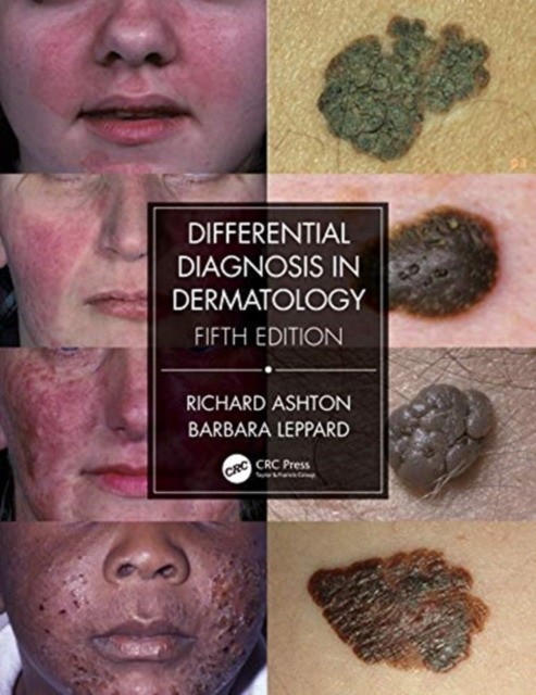 Differential diagnosis in dermatology