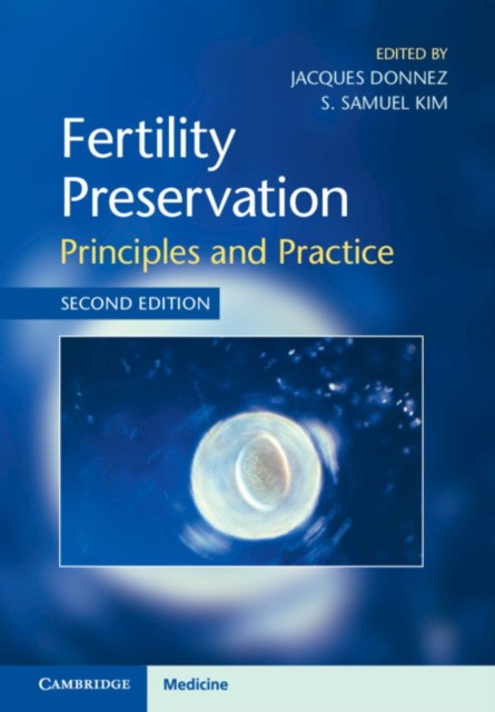 Fertility Preservation: Principles and Practice