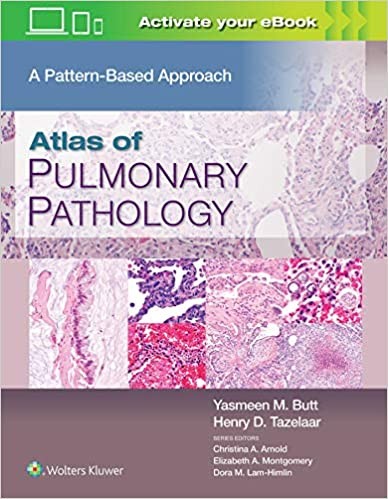Atlas Of Pulmonary Pathology Atlas Of Pulmonary Pathology