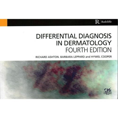 Differential Diagnosis in Dermatology