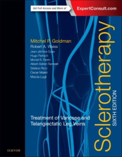 Sclerotherapy, Treatment of Varicose and Telangiectatic Leg Veins, 6th Edition