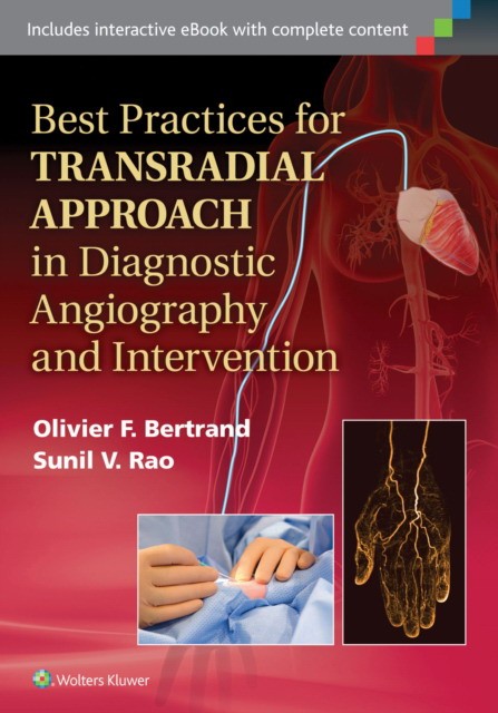 Best Practices for Transradial Approach in Diagnostic Angiography and Intervention Best Practices for Transradial Approach in Diagnostic Angiography and Intervention