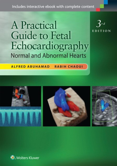 A Practical Guide to Fetal Echocardiography: Normal and Abnormal Hearts 3e