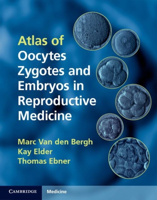 Atlas of Oocytes, Zygotes and Embryos in Reproductive Medicine Hardback with CD-ROM