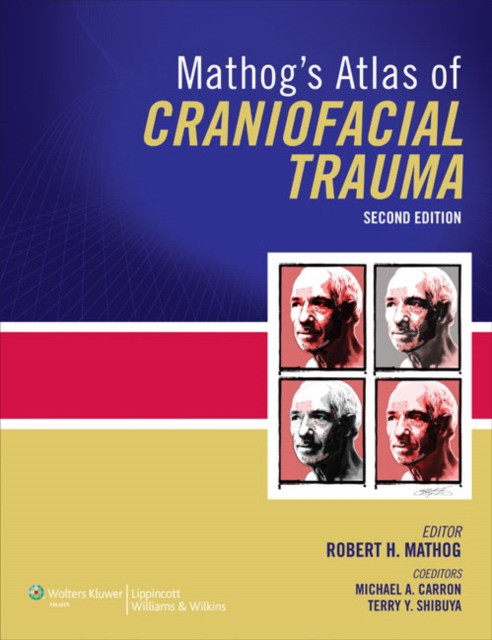 Atlas Of Craniofacial Trauma 2E