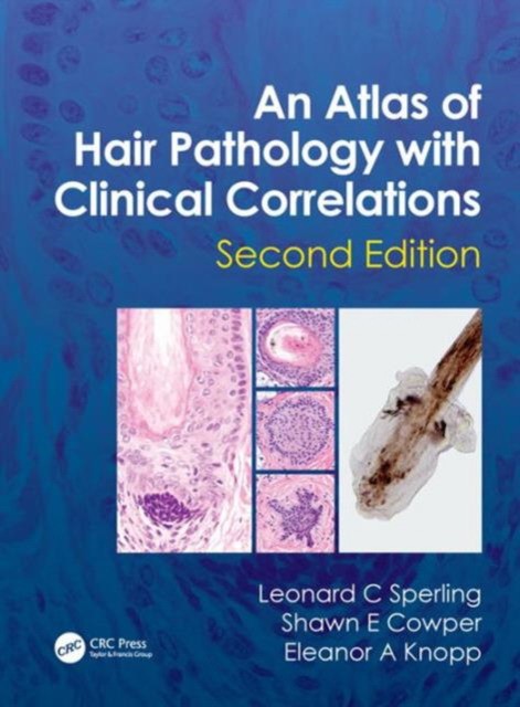 An Atlas of Hair Pathology with Clinical Correlations, 2 Ed.