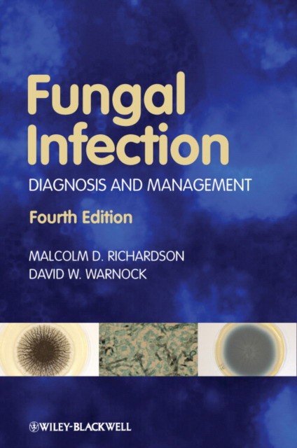 Fungal Infection: Diagnosis and Management, 4th Edition