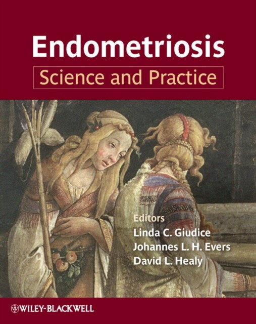 Endometriosis: Science and Practice