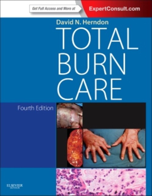 Total Burn Care,
