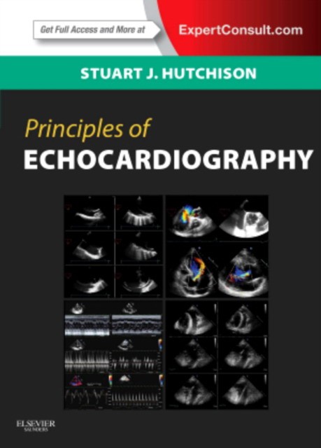 Principles of Echocardiography and Intracardiac Echocardiography,