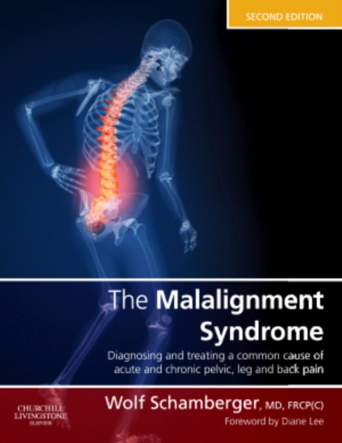 The malalignment syndrome, 2nd edition