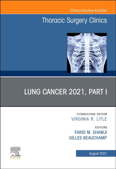 Lung Cancer 2021, Part 1, an Issue of Thoracic Surgery Clinics, 31