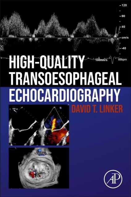 High Quality Transoesophageal Echocardiography