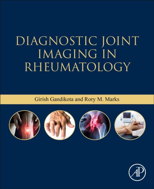 Diagnostic Joint Imaging In Rheumatology
