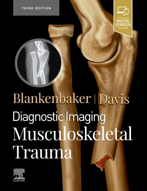 Diagnostic Imaging: Musculoskeletal Trauma