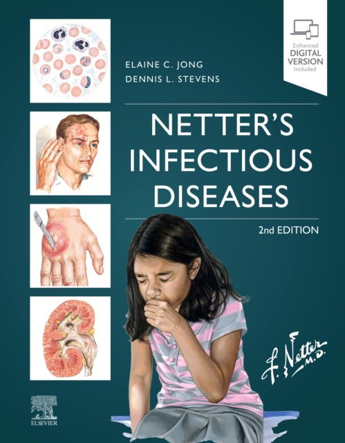Netter'S Infectious Diseases, 2 ed.