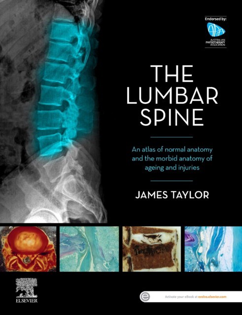 Anatomy Of The Lumbar Spine Anatomy Of The Lumbar Spine