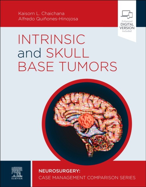 Intrinsic And Skull Base Tumors