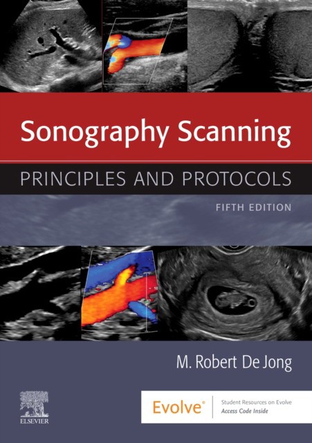 Sonography scanning