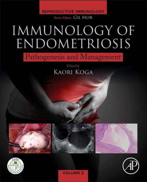 Immunology Of Endometriosis: Etiology And Management