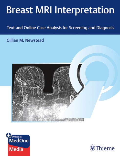 Breast MRI Interpretation: Text and Online Case Analysis for Screening and Diagnosis
