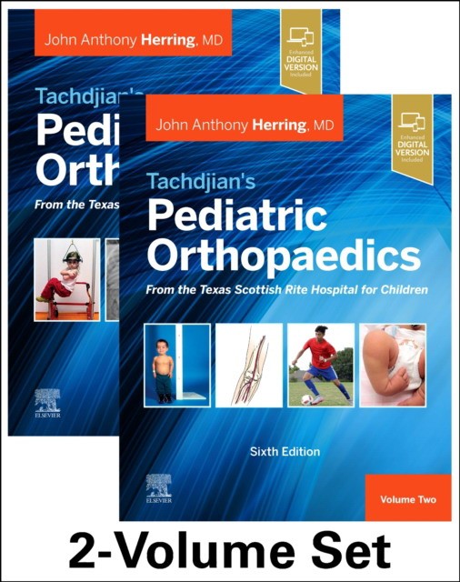 Tachdjian's Pediatric Orthopaedics: From the Texas Scottish Rite Hospital for Children, 6th edition