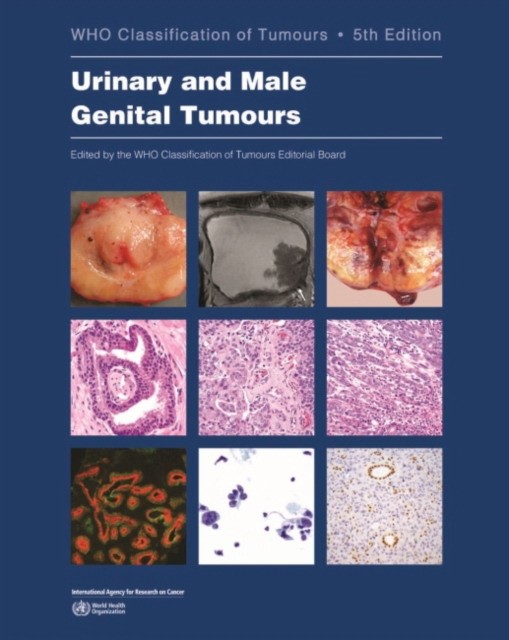 Who Classification of Tumour: Urinary and Male Genital Tumours 8 Vol