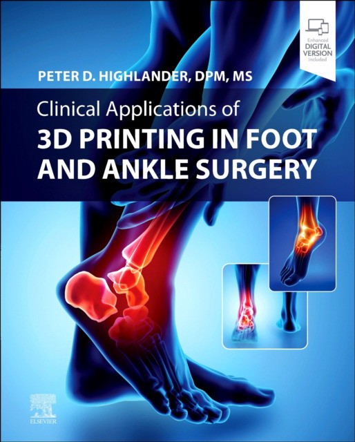 Clinical applications of 3d printing in foot and ankle surgery