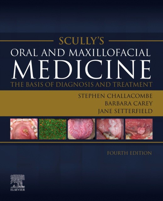 Scully`s oral and maxillofacial medicine: the basis of diagnosis and treatment