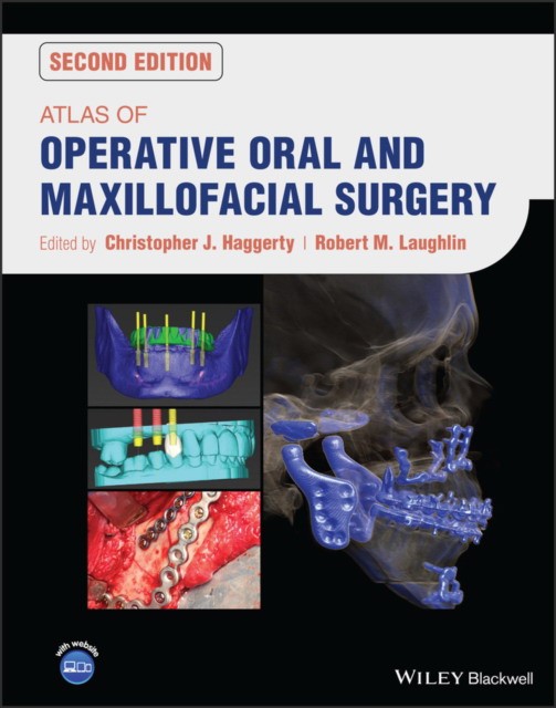 Atlas of operative oral and maxillofacial surgery, 2 ed.
