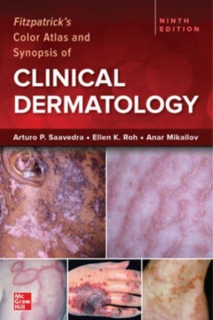 Fitzpatrick`s color atlas and synopsis of clinical dermatology, 9 edition