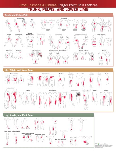 Travell, simons & simons trigger point pain patterns wall   chart
