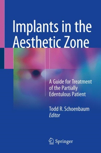 Implants in the Aesthetic Zone
