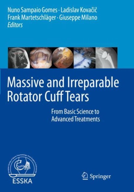 Massive and Irreparable Rotator Cuff Tears: From Basic Science to Advanced Treatments