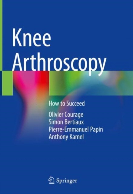 Knee Arthroscopy: How to Succeed